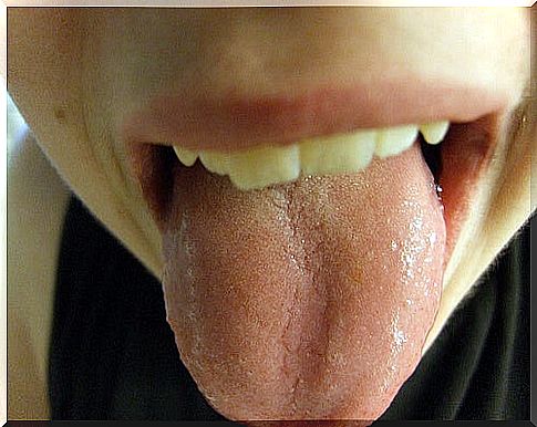 Lesions on your tongue.