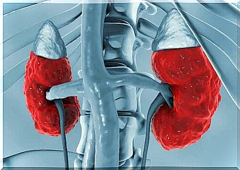 A diagram of the two kidneys