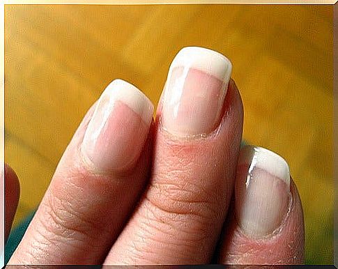 Nails and health: Discolored nails are a sign of dysfunction.