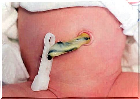 Cutting the umbilical cord of a newborn baby