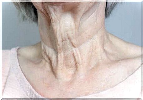 wrinkles on a woman's neck