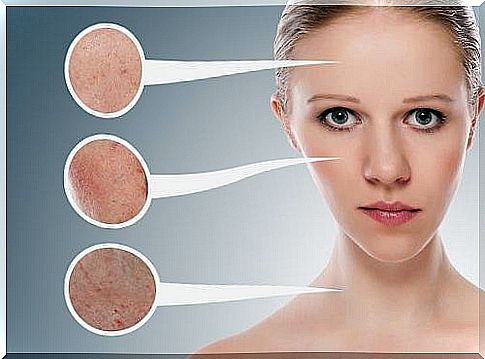 Different skin problems for the forehead, cheeks and neck