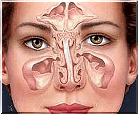 Treat sinusitis naturally